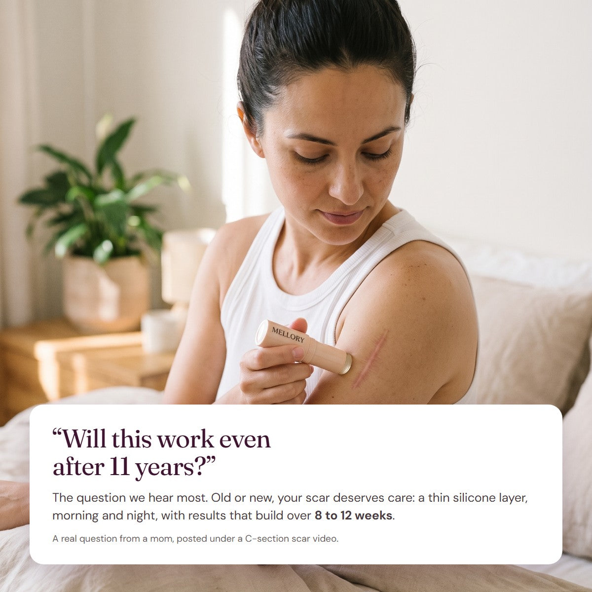 Woman applying the Mellory stick to a scar on her upper arm