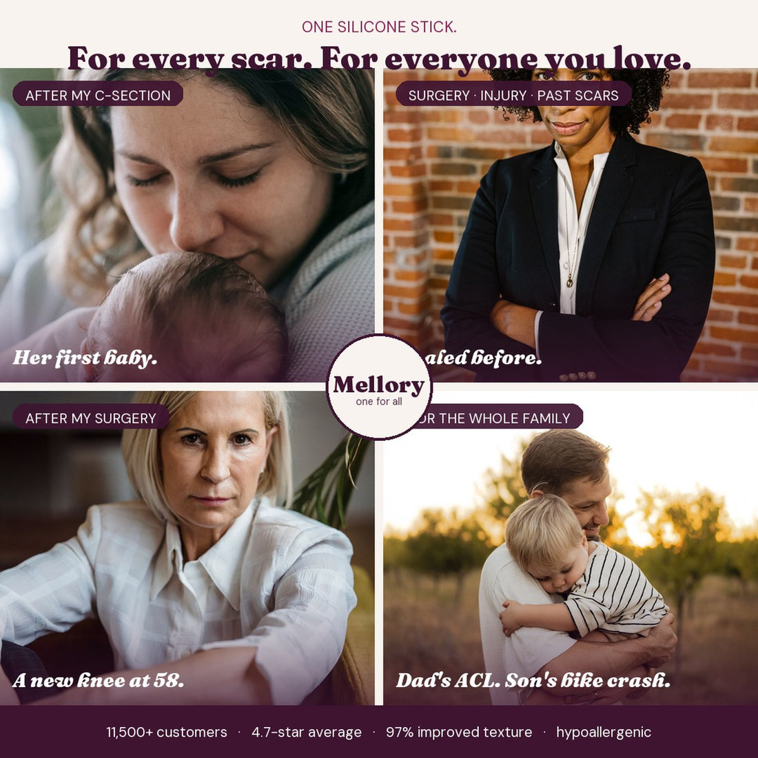 One silicone stick for every scar: C-section, past surgery or injury, mature post-surgery, the whole family. 11,500+ customers, 4.7-star average, 97% improved texture, hypoallergenic.