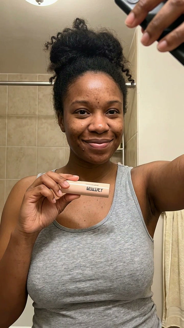 C-section scar, 3 years on
