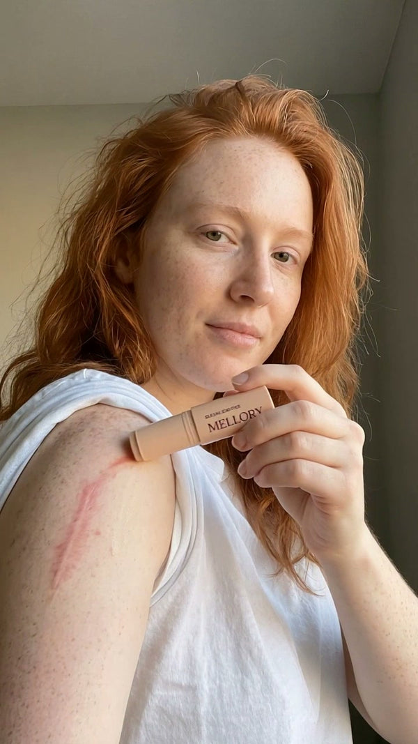Surgery scar on the arm