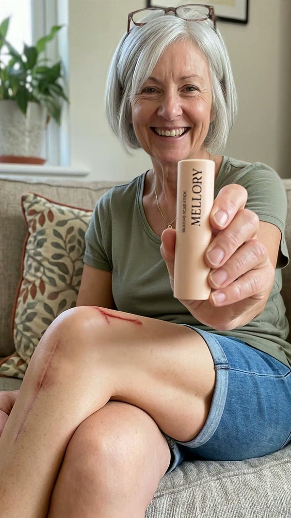 Knee replacement scar
